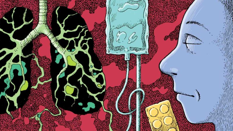 Cáncer de pulmón y quimioterapia - Ilustración de Walther Sorg